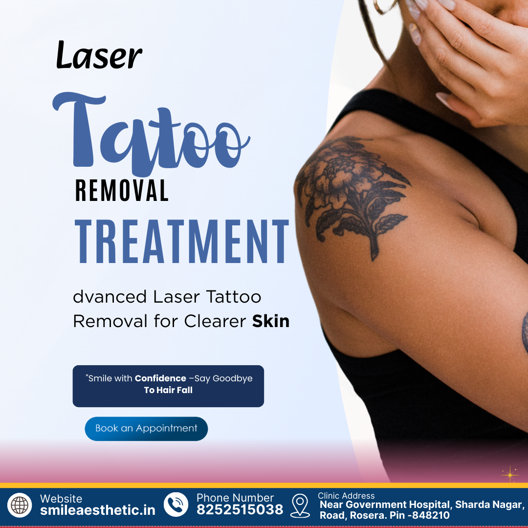 Laser Tattoo Removal Treatment – Safe & Advanced Solution for Clear Skin
